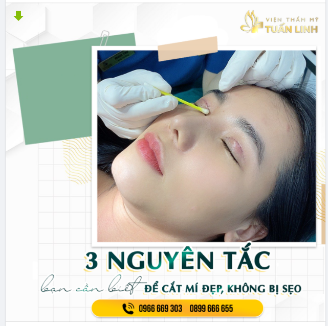 ĐỌC NGAY 3 NGUYÊN TẮC CẮT MÍ SAU ĐÂY ĐỂ CÓ ĐÔI MẮT ĐẸP RẠNG NGỜI.