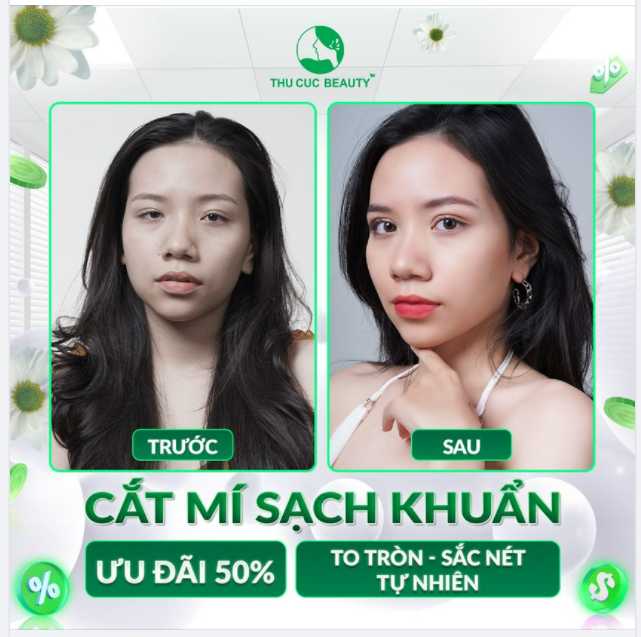 ĐÔI MẮT ĐẸP LÀ ĐÔI MẮT CÓ NẾP MÍ CHUẨN TỶ LỆ