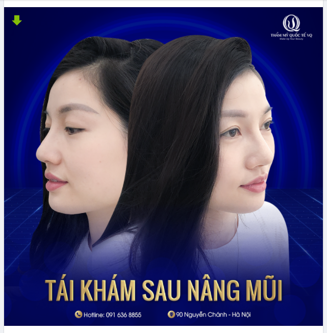 Dù ai đi ngược về xuôi. Nhớ sau 7 ngày là tái khám mũi các bạn nhé