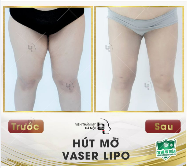 ĐÙI TO......AI MÀ CHẲNG SỢ.