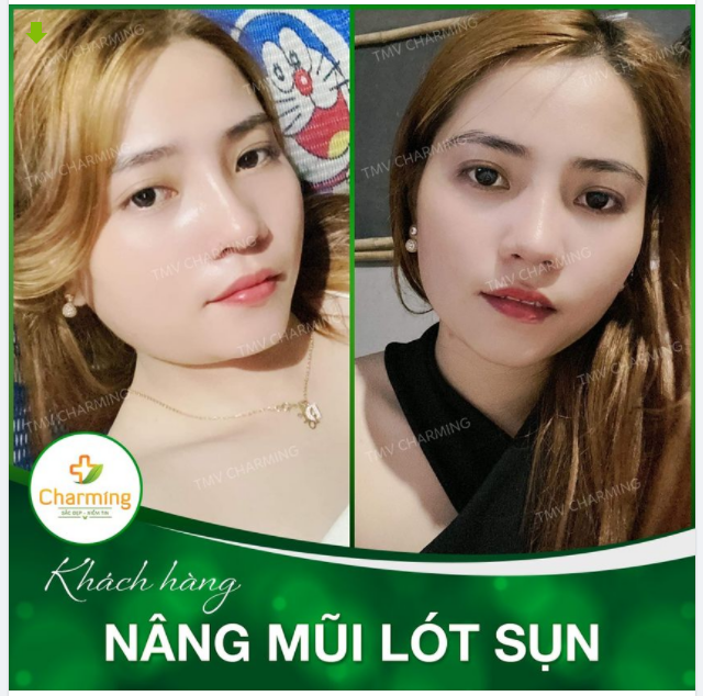 Đừng ai hỏi Charming điều gì ngọt ngào nhất. Với Charming thì không gì ngọt ngào bằng những lời khen của các bạn dành tặng cho Charming đâu.