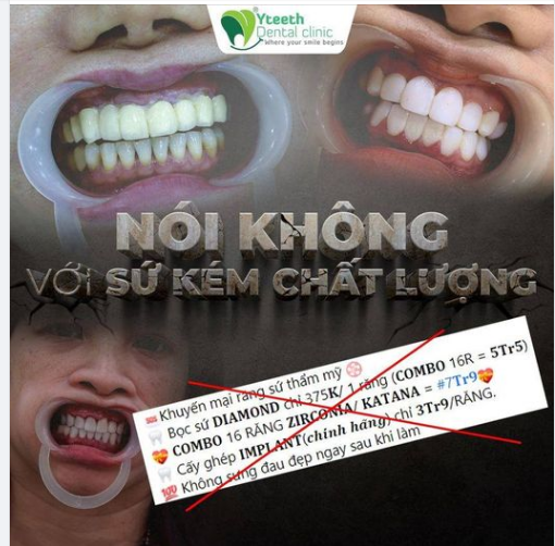 ĐỪNG CHỈ QUAN TÂM TỚI GIÁ RẺ KHI QUYẾT ĐỊNH BỌC RĂNG SỨ