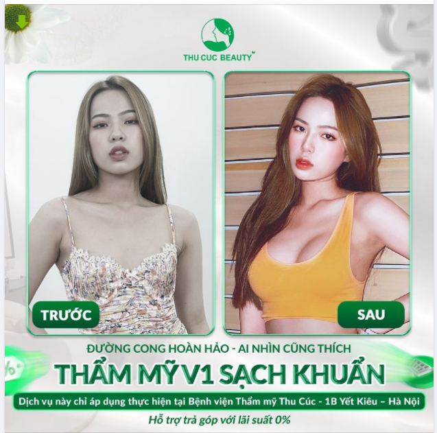 Đường cong hoàn hảo - Ai nhìn cũng thích Bí quyết đằng sau chính là Thẩm Mỹ V1 Sạch Khuẩn