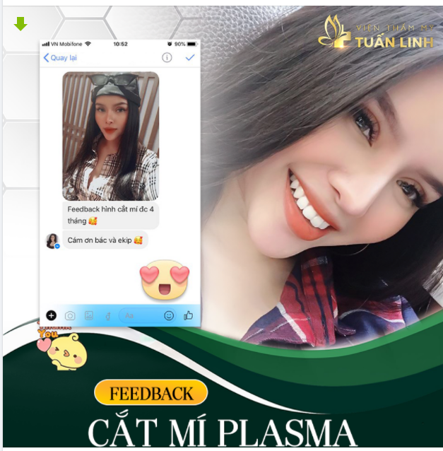 FEEDBACK CẮT MÍ SAU 4 THÁNG TẠI TUẤN LINH.