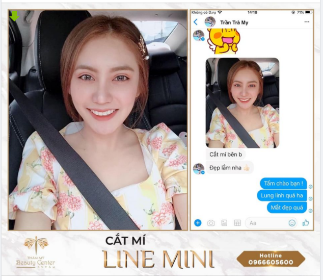 Feedback của khách hàng cắt mí Line Mini.