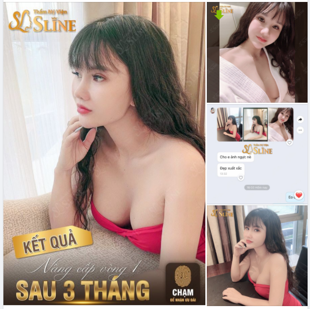 FEEDBACK NÂNG CẤP VÒNG 1