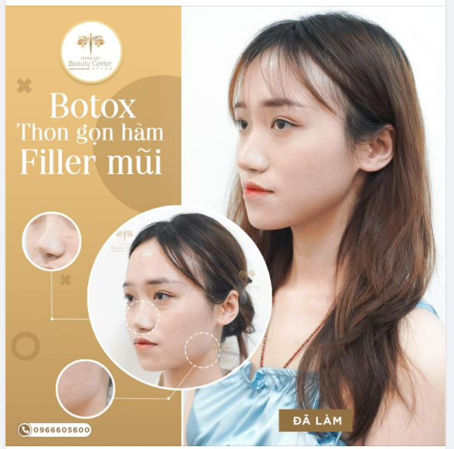 FILLER MŨI VÀ BOTOX GỌN HÀM