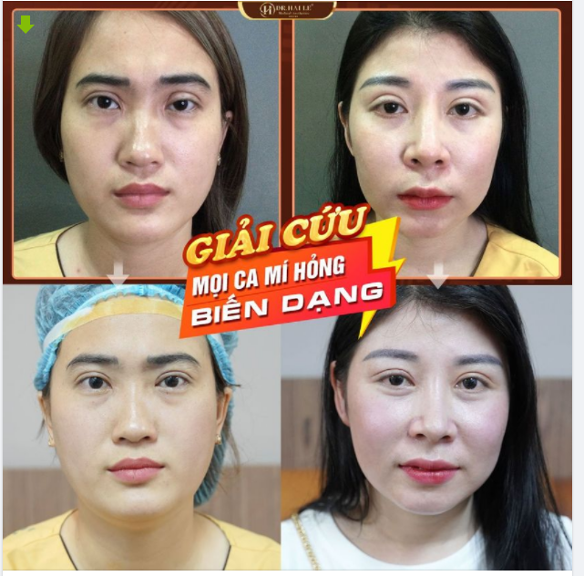 "GIẢI CỨU MÍ HỎNG" - DR.HẢI LÊ ĐỒNG HÀNH CÙNG BẠN!