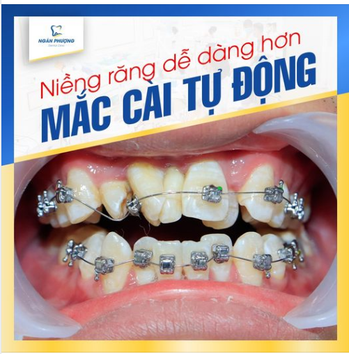 Giảm thời gian tới nha khoa thăm khám
