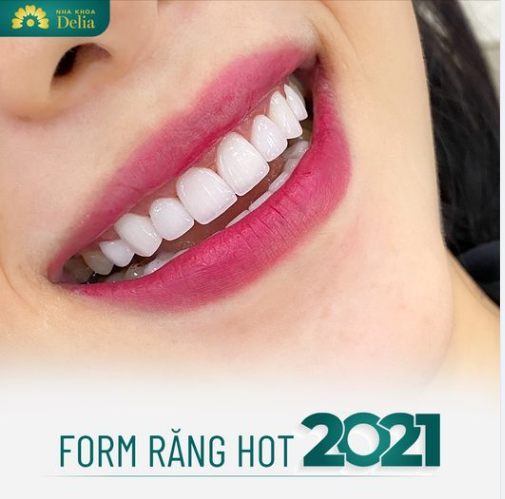 Giới thiệu với cả nhà mẫu form răng cá tính hot hit 2021 được thiết kế bởi bác sĩ nhà Delia