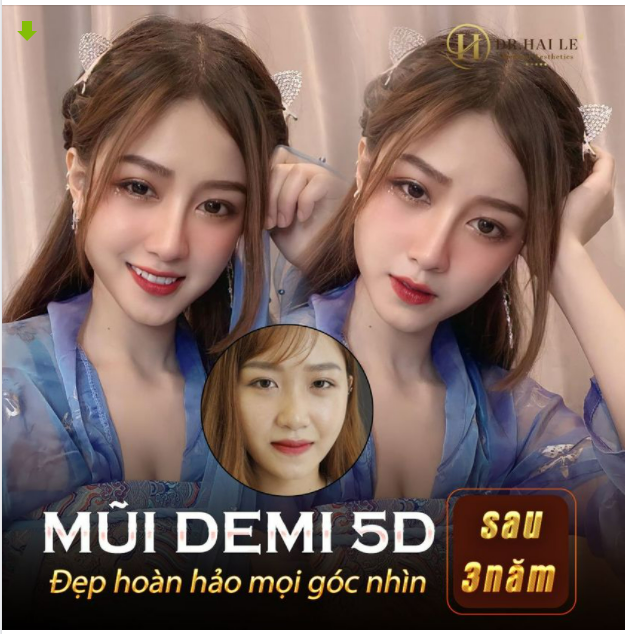 Gửi đến mọi người một dáng mũi Demi 5D "đẹp mọi góc nhìn" 3 năm tuổi.