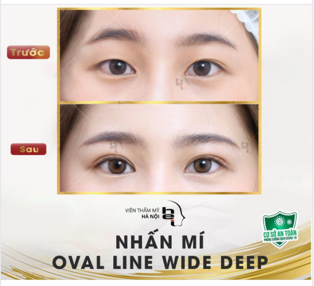 HÀNH TRÌNH ĐI TÌM ĐIỂM NHẤN CHO ĐÔI MẮT ĐẸP ẢNH THẬT - NGƯỜI THẬT - KẾT QUẢ THẬT