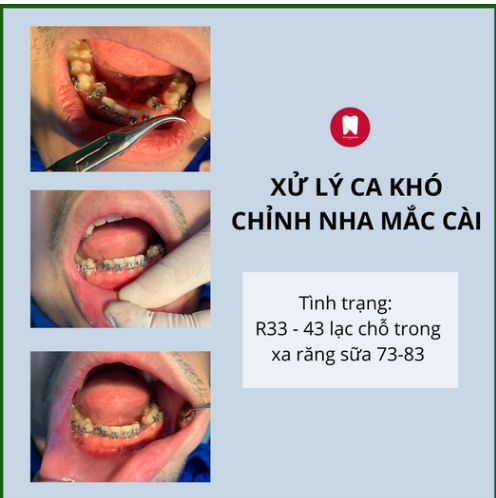HÀNH TRÌNH VẠN DẶM ĐỀU BẮT ĐẦU TỪ MỘT BƯỚC CHÂN