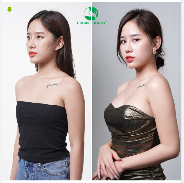 Hết LÉP là ĐẸP - Nét quyến rũ không thể chối từ