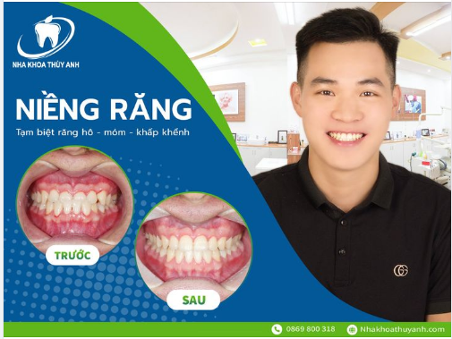 HẾT NGAY MÓM MÀ RĂNG KHỎE MẠNH CHỈ SAU 6 THÁNG