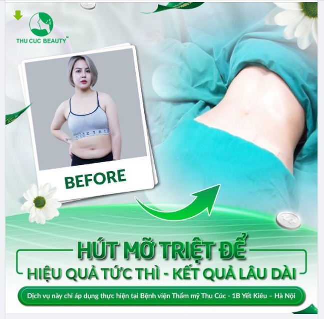 HIỆU QUẢ TỨC THÌ - KẾT QUẢ LÂU DÀI CHỈ CÓ THỂ LÀ THẨM MỸ V2 SẠCH KHUẨN!
