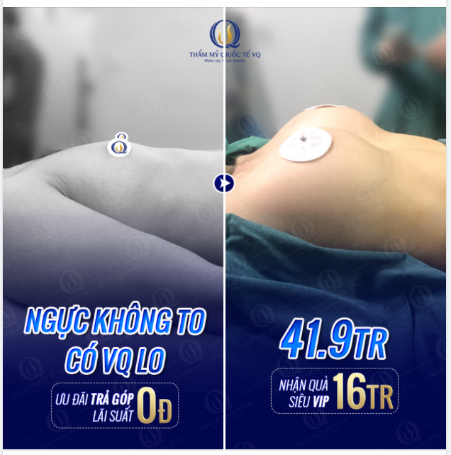 Hình ảnh trước và sau khi nâng v1 của khách hàng nhà VQ để tham khảo.