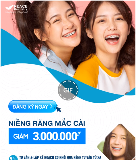 HỖ TRỢ THEO CÁCH TỐT NHẤT DÀNH CHO KHÁCH HÀNG NIỀNG RĂNG!