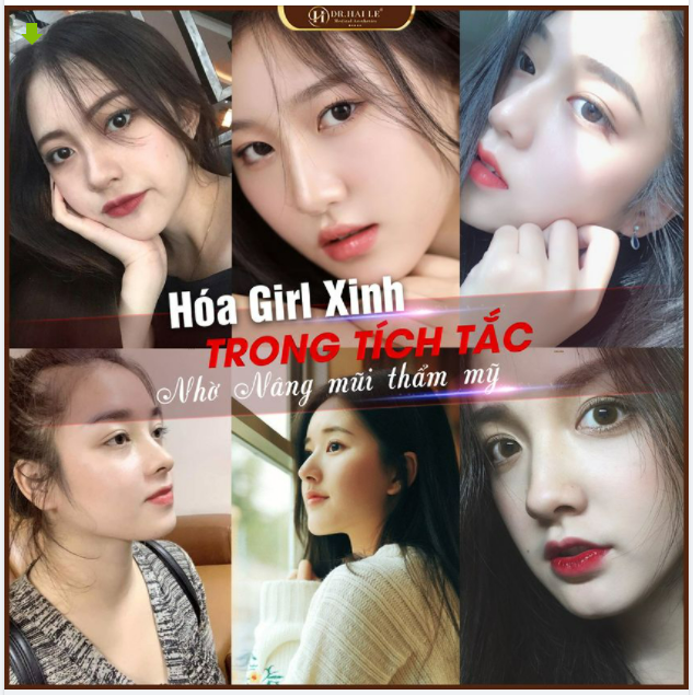 Hóa GIRL XINH trong tích tắc nhờ NÂNG MŨI THẨM MỸ.