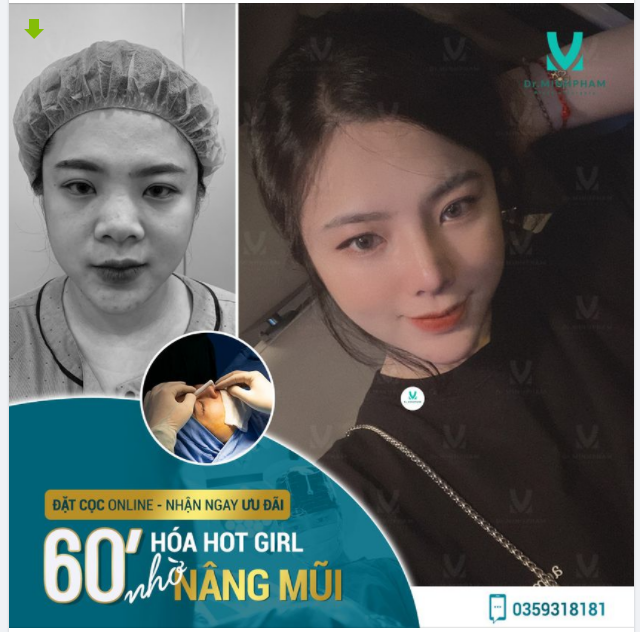 HOÁ HOT GIRL KHÔNG KHÓ CHỈ CẦN CÓ DÁNG MŨI XINH