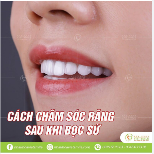 HƯỚNG DẪN CÁCH CHĂM SÓC RĂNG SAU KHI BỌC SỨ.