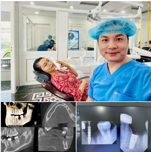 IMPLANT nha khoa giải pháp tốt nhất cho người mất răng.