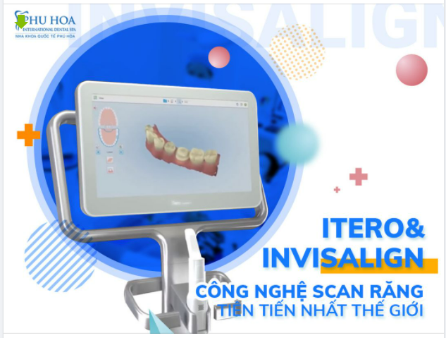 ITERO INVISALIGN: CÔNG NGHỆ SCAN RĂNG TIÊN TIẾN