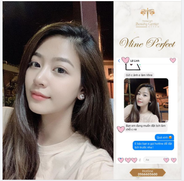 Khách hàng feedback hàm bị gọn quá rồi Tấm ơi!!!