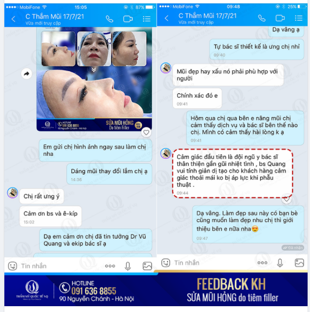 KHÁCH HÀNG SỬA MŨI NÓI GÌ VỀ DR VŨ QUANG ????