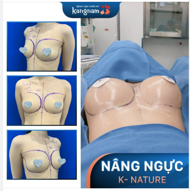 Khi đi 2 tiểu màn thầu Khi về đã có 2 chiếc bánh bao căng tròn
