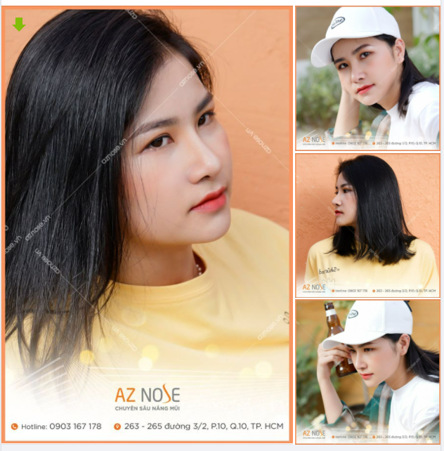 Khoe nhẹ dáng mũi Sline cao 5 năm tuổi nhà AZ NOSE
