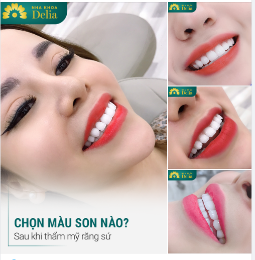 KHÔNG CẦN CHỌN MÀU SON!  -  Răng sứ Delia phù hợp với tất cả các màu!