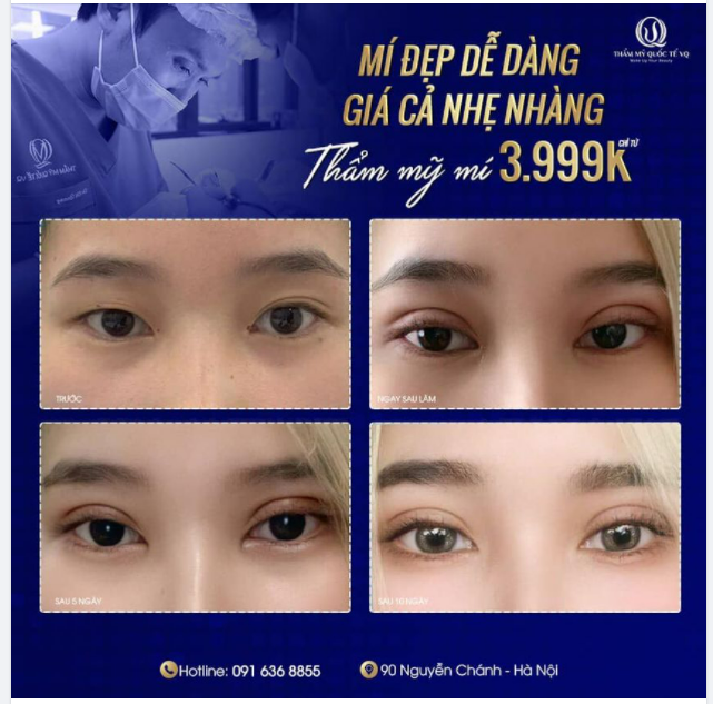 KHÔNG CHỈ NÂNG MŨI ĐẸP - VQ CÒN THẨM MỸ MÍ CỰC XINH