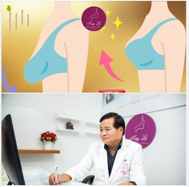 KIẾN TẠO VÒNG 1 CĂNG TRÒN SĂN CHẮC VỚI THẨM MỸ TÁI TẠO NGỰC XỆ