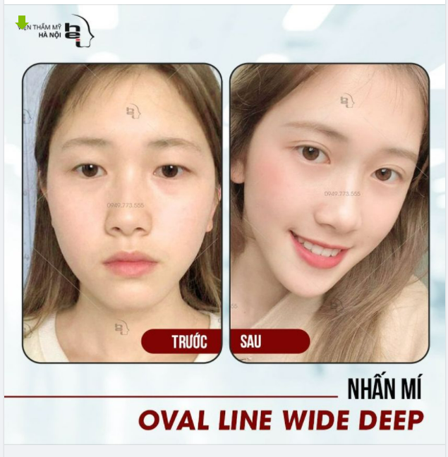 "Là con gái đừng ngại đầu tư vào ngoại hình nhé!"