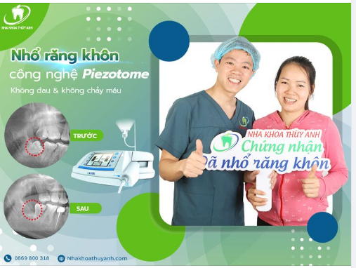 LOẠI BỎ RĂNG KHÔN - ĂN NGON KHÔNG LO BIẾN CHỨNG