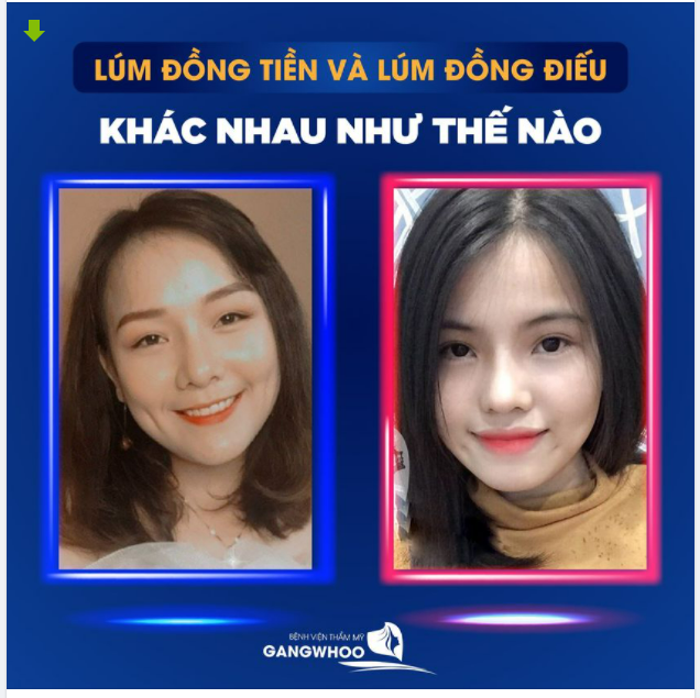 LÚM ĐỒNG TIỀN VÀ LÚM ĐỒNG ĐIỀU KHÁC NHAU NHƯ THẾ NÀO?