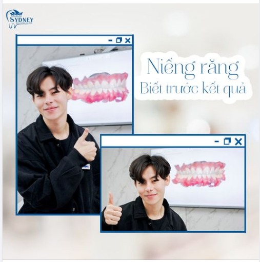LƯU Ý DÀNH CHO CÁC BẠN NIỀNG RĂNG INVISALIGN