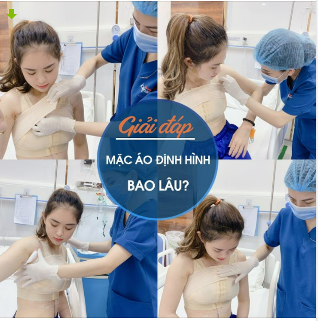 MẶC ÁO ĐỊNH HÌNH SAU PHẪU THUẬT NÂNG NGỰC TRONG BAO LÂU?