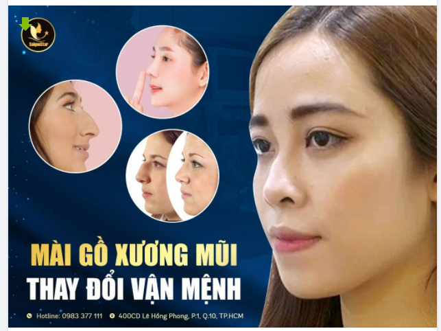 MÀI GỒ XƯƠNG MŨI - THAY ĐỔI VẬN MỆNH