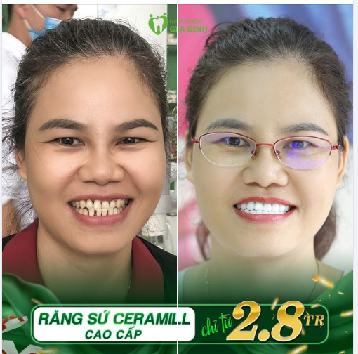 MÃN NGUYỆN VỚI NỤ CƯỜI ĐẸP KHÔNG TÌ VẾT