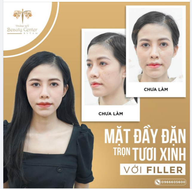 MẶT ĐẦY ĐẶN- TRỌN TƯƠI XINH