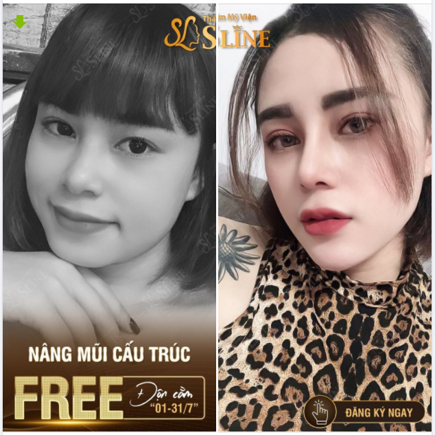MẶT ĐẸP NHƯ Ý - KHÔNG LO CHI PHÍ