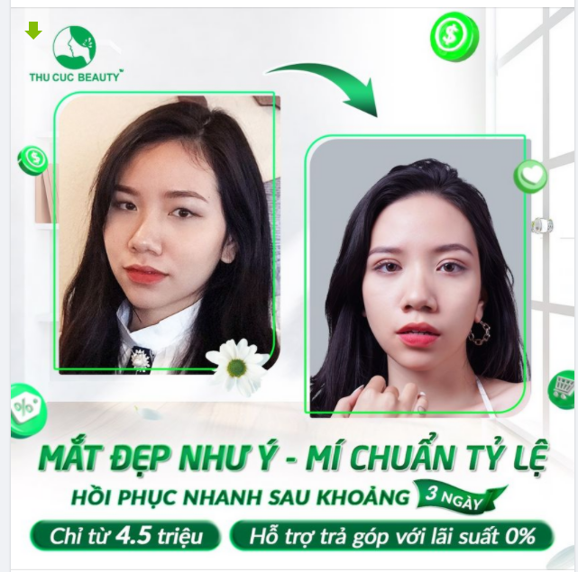 MẮT ĐẸP NHƯ Ý - MÍ CHUẨN TỶ LỆ