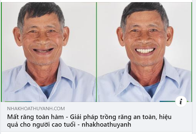 MẤT RĂNG VÀ GIẢI PHÁP TRỒNG RĂNG AN TOÀN, HIỆU QUẢ CHO NGƯỜI CAO TUỔI