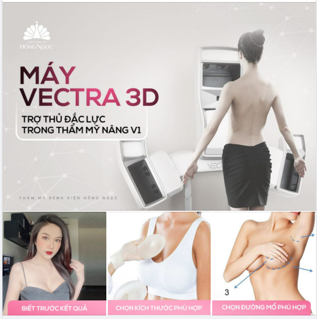MÁY VECTRA 3D - TRỢ THỦ ĐẮC LỰC TRONG NÂNG CẤP V1