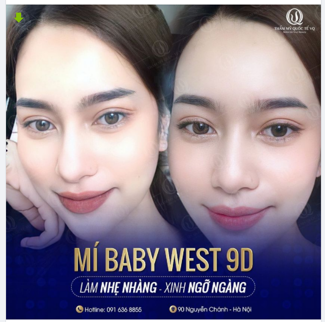 MÍ BABY WEST 9D - LÀM NHẸ NHÀNG - XINH NGỠ NGÀNG