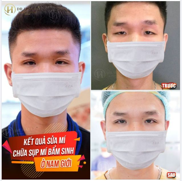 MÍ KHÓ, MÍ XẤU ĐẾN ĐÂU - DR.HẢI LÊ CŨNG "XỬ LÝ" ĐẸP HẾT.!!