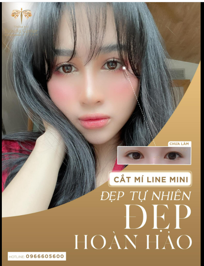 MÍ SỤP - MỘT MÍ CHƯA BAO GIỜ LÀ VẤN ĐỀ VỚI TẤM 