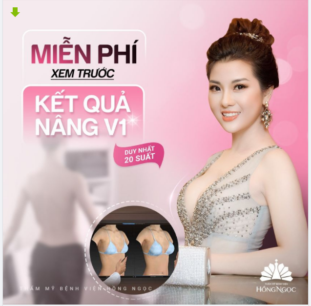 MIỄN PHÍ XEM TRƯỚC KẾT QUẢ THOÁT TEO LÉP V1 ĐẸP TRỌN ĐỜI